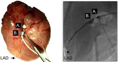 Altered blood gas tensions of oxygen and carbon dioxide confound coronary reactivity to apnea